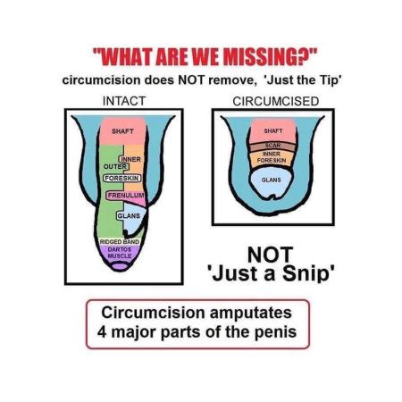 penis necircumcis|What to Know About Being Circumcised vs.